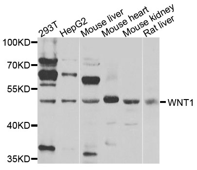WNT1 Antibody - Western blot analysis of extracts of various cells.