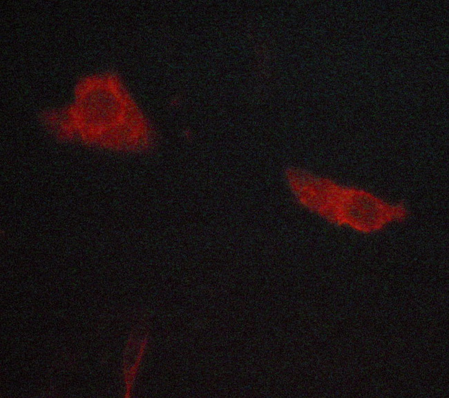 WNT1 Antibody - Staining LOVO cells by IF/ICC. The samples were fixed with PFA and permeabilized in 0.1% saponin prior to blocking in 10% serum for 45 min at 37°C. The primary antibody was diluted 1/400 and incubated with the sample for 1 hour at 37°C. A Alexa Fluor® 594 conjugated goat polyclonal to rabbit IgG (H+L), diluted 1/600 was used as secondary antibody.