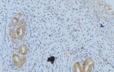 WNT1 Antibody - 1:100 staining human uterus tissue by IHC-P. The sample was formaldehyde fixed and a heat mediated antigen retrieval step in citrate buffer was performed. The sample was then blocked and incubated with the antibody for 1.5 hours at 22°C. An HRP conjugated goat anti-rabbit antibody was used as the secondary.