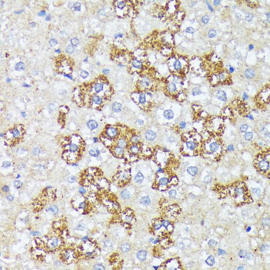 WNT1 Antibody - Immunohistochemistry of paraffin-embedded Rat liver using WNT1 Polyclonal Antibody at dilution of 1:100 (40x lens).