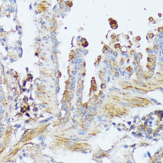 WNT1 Antibody - Immunohistochemistry of paraffin-embedded Mouse lung using WNT1 Polyclonal Antibody at dilution of 1:100 (40x lens).