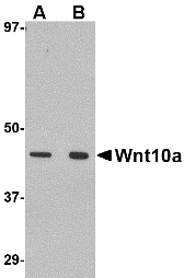 WNT10A Antibody - Western blot of Wnt10a in RAW264.7 cell lysate with Wnt10a antibody at (A) 1 and (B) 2 ug/ml.