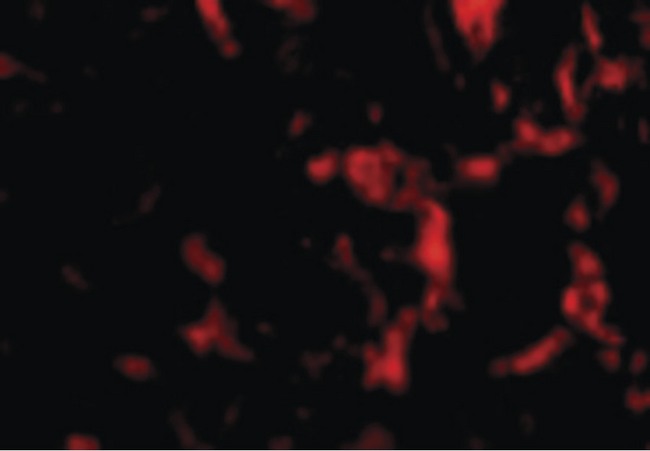 WNT10A Antibody - Immunofluorescence of Wnt10a in Human Skeletal Muscle cells with Wnt10a antibody at 20 ug/ml.