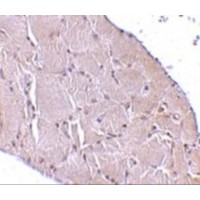 WNT10A Antibody - Immunohistochemistry of Wnt10a in human skeletal muscle tissue with Wnt10a antibody at 10 µg/mL.