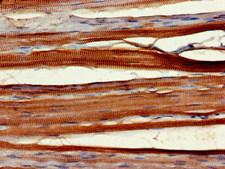 WNT10A Antibody - Immunohistochemistry of paraffin-embedded human skeletal muscle tissue at dilution of 1:100