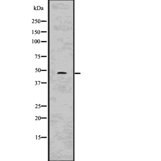 WNT10A Antibody - Western blot analysis of Wnt10a using COLO205 whole cells lysates