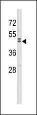 WNT10B Antibody - Western blot of WNT10B Antibody in MDA-MB231 cell line lysates (35 ug/lane). WNT10B (arrow) was detected using the purified antibody.