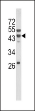 WNT10B Antibody - Western blot of WNT10B Antibody in mouse liver tissue lysates (35 ug/lane). WNT10B (arrow) was detected using the purified antibody.