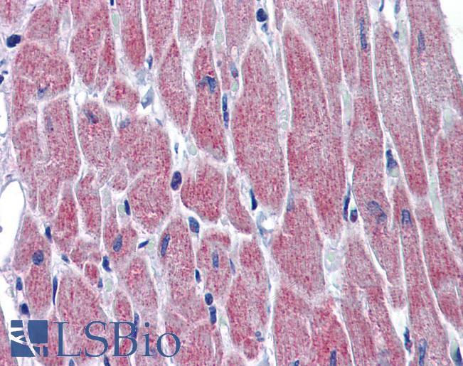 WNT10B Antibody - Anti-WNT10B antibody IHC of human heart. Immunohistochemistry of formalin-fixed, paraffin-embedded tissue after heat-induced antigen retrieval. Antibody concentration 5 ug/ml.  This image was taken for the unconjugated form of this product. Other forms have not been tested.