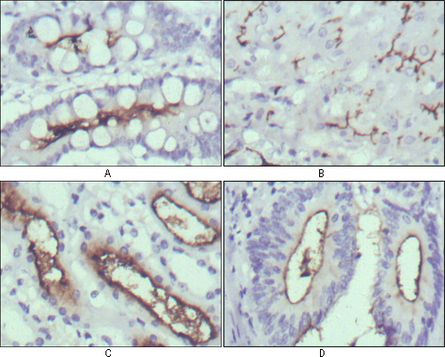 WNT10B Antibody - IHC of paraffin-embedded human normal stomach (A), normal liver (B), normal kidney (C) and rectum cancer tissues (D) using WNT10B mouse monoclonal antibody with DAB staining.