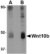 WNT10B Antibody - Western blot of Wnt10b in human skeletal muscle tissue lysate with Wnt10b antibody at (A) 2 and (B) 4 ug/ml.