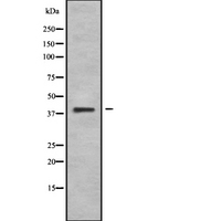 WNT10B Antibody - Western blot analysis of WN10B using Jurkat whole cells lysates