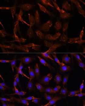 WNT10B Antibody - Immunofluorescence analysis of C6 cells using WNT10B Polyclonal Antibody at dilution of 1:100.Blue: DAPI for nuclear staining.