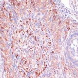 WNT10B Antibody - Immunohistochemistry of paraffin-embedded Rat ovary using WNT10B Polyclonal Antibody at dilution of 1:100 (40x lens).