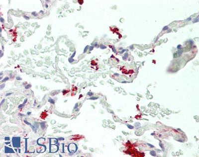 WNT11 Antibody - Human Lung: Formalin-Fixed, Paraffin-Embedded (FFPE).  This image was taken for the unconjugated form of this product. Other forms have not been tested.