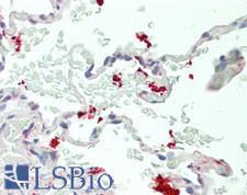 WNT11 Antibody - Human Lung: Formalin-Fixed, Paraffin-Embedded (FFPE).  This image was taken for the unconjugated form of this product. Other forms have not been tested.