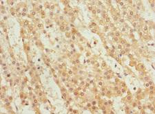 WNT14 / WNT9A Antibody - Immunohistochemistry of paraffin-embedded human adrenal gland tissue at dilution 1:100