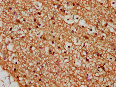 WNT14 / WNT9A Antibody - IHC image of WNT9A Antibody diluted at 1:245 and staining in paraffin-embedded human brain tissue performed on a Leica BondTM system. After dewaxing and hydration, antigen retrieval was mediated by high pressure in a citrate buffer (pH 6.0). Section was blocked with 10% normal goat serum 30min at RT. Then primary antibody (1% BSA) was incubated at 4°C overnight. The primary is detected by a biotinylated secondary antibody and visualized using an HRP conjugated SP system.
