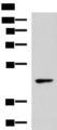 WNT14 / WNT9A Antibody - Western blot analysis of 293T cell lysate  using WNT9A Polyclonal Antibody at dilution of 1:500