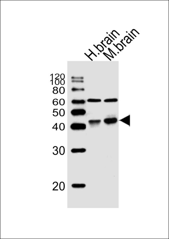 WNT16 Antibody - Western blot of lysates from human brain, mouse brain tissue (from left to right), using WNT16 Antibody. Antibody was diluted at 1:1000 at each lane. A goat anti-rabbit IgG H&L (HRP) at 1:10000 dilution was used as the secondary antibody. Lysates at 20ug per lane.