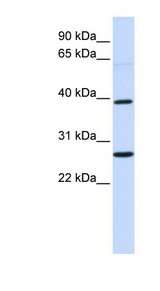 WNT16 Antibody - WNT16 antibody Western blot of Fetal Brain lysate. This image was taken for the unconjugated form of this product. Other forms have not been tested.