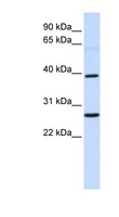 WNT16 Antibody - WNT16 antibody Western blot of Fetal Brain lysate. This image was taken for the unconjugated form of this product. Other forms have not been tested.