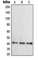 WNT16 Antibody - Western blot analysis of WNT16 expression in HepG2 (A); Raji (B); Ramos (C) whole cell lysates.
