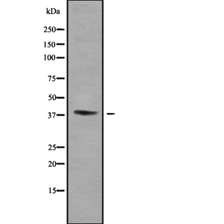 WNT16 Antibody - Western blot analysis of WNT16 using Jurkat whole cells lysates