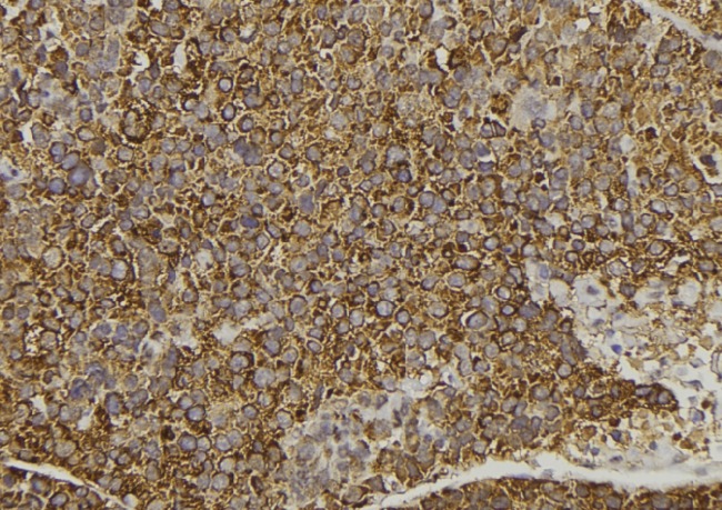WNT16 Antibody - 1:100 staining human pancreas tissue by IHC-P. The sample was formaldehyde fixed and a heat mediated antigen retrieval step in citrate buffer was performed. The sample was then blocked and incubated with the antibody for 1.5 hours at 22°C. An HRP conjugated goat anti-rabbit antibody was used as the secondary.