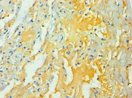 WNT2 / IRP Antibody - Immunohistochemistry of paraffin-embedded human lung using antibody at 1:100 dilution.