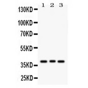 WNT2 / IRP Antibody - WNT2 antibody Western blot. All lanes: Anti WNT2 at 0.5 ug/ml. Lane 1: COLO320 Whole Cell Lysate at 40 ug. Lane 2: MCF-7 Whole Cell Lysate at 40 ug. Lane 3: HELA Whole Cell Lysate at 40 ug. Predicted band size: 40 kD. Observed band size: 40 kD.