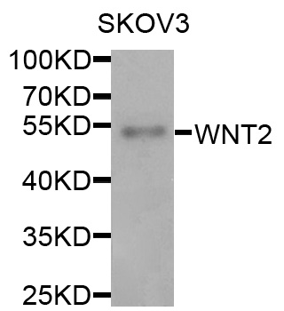WNT2 / IRP Antibody - Western blot analysis of extracts of various cells.