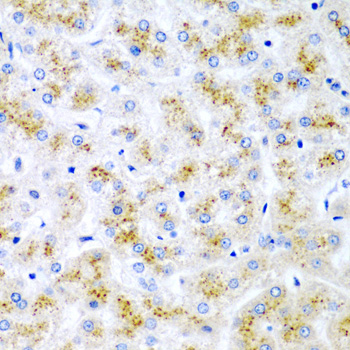 WNT2 / IRP Antibody - Immunohistochemistry of paraffin-embedded human liver injury tissue.