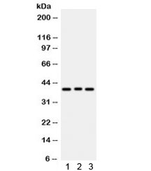 WNT2 / IRP Antibody
