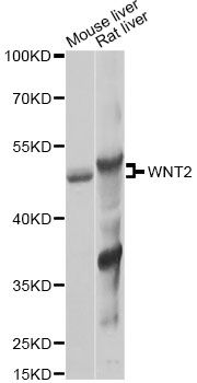 WNT2 / IRP Antibody - Western blot analysis of extracts of various cell lines, using WNT2 Antibody at 1:1000 dilution. The secondary antibody used was an HRP Goat Anti-Rabbit IgG (H+L) at 1:10000 dilution. Lysates were loaded 25ug per lane and 3% nonfat dry milk in TBST was used for blocking. An ECL Kit was used for detection and the exposure time was 10s.