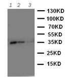 WNT2B Antibody - WB of WNT2B antibody. Recombinant Protein Detection Source:. E.coli derived -recombinant Human WNT2B, 35.78KD. (162aa tag+ R101-A254). . Lane 1: Recombinant Human WNT2B Protein 10ng. Lane 2: Recombinant Human WNT2B Protein 5ng. Lane 3: Recombinant Human WNT2B Protein 2.5ng.