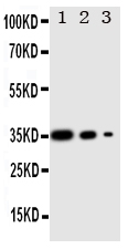 WNT2B Antibody - Anti-Wnt2b antibody, Western blottingRecombinant Protein Detection Source :E. coli derived -recombinant Human WNT2B, 35. 78KD (162aa tag+ R101-A254) Lane 1: Recombinant Human WNT2B Protein 10ng Lane 2: Recombinant Human WNT2B Protein 5ng Lane 3: Recombinant Human WNT2B Protein 2. 5ng