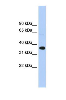 WNT2B Antibody - WNT2B antibody Western blot of HepG2 Cell lysate. Antibody concentration 1 ug/ml. This image was taken for the unconjugated form of this product. Other forms have not been tested.