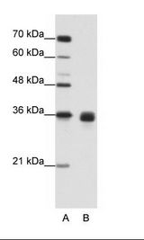 WNT2B Antibody - B: Jurkat Cell Lysate.  This image was taken for the unconjugated form of this product. Other forms have not been tested.