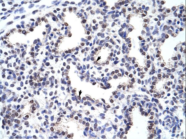 WNT2B Antibody - WNT2B antibody ARP41254_T100-NP_004176-WNT2B (wingless-type MMTV integration site family, member 2B) Antibody was used in IHC to stain formalin-fixed, paraffin-embedded human lung.  This image was taken for the unconjugated form of this product. Other forms have not been tested.