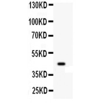 WNT2B Antibody - WNT2B antibody Western blot. All lanes: Anti WNT2B at 0.5 ug/ml. WB: 22RV1 Whole Cell Lysate at 40 ug. Predicted band size: 44 kD. Observed band size: 44 kD.