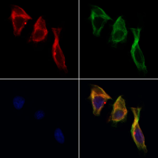 WNT2B Antibody - Staining HeLa cells by IF/ICC. The samples were fixed with PFA and permeabilized in 0.1% Triton X-100, then blocked in 10% serum for 45 min at 25°C. Samples were then incubated with primary Ab(1:200) and mouse anti-beta tubulin Ab(1:200) for 1 hour at 37°C. An AlexaFluor594 conjugated goat anti-rabbit IgG(H+L) Ab(1:200 Red) and an AlexaFluor488 conjugated goat anti-mouse IgG(H+L) Ab(1:600 Green) were used as the secondary antibod
