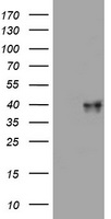 WNT3 Antibody - HEK293T cells were transfected with the pCMV6-ENTRY control (Left lane) or pCMV6-ENTRY WNT3 (Right lane) cDNA for 48 hrs and lysed. Equivalent amounts of cell lysates (5 ug per lane) were separated by SDS-PAGE and immunoblotted with anti-WNT3.