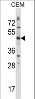 WNT3 Antibody - WNT3 Antibody western blot of CEM cell line lysates (35 ug/lane). The WNT3 antibody detected the WNT3 protein (arrow).
