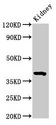 WNT3 Antibody - Western Blot Positive WB detected in: mouse kidney tissue All lanes: Wnt3 antibody at 3.2µg/ml Secondary Goat polyclonal to rabbit IgG at 1/50000 dilution Predicted band size: 40 kDa Observed band size: 40 kDa
