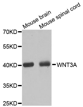 WNT3A Antibody - Western blot analysis of extracts of various cell lines, using WNT3A antibody at 1:1000 dilution. The secondary antibody used was an HRP Goat Anti-Rabbit IgG (H+L) at 1:10000 dilution. Lysates were loaded 25ug per lane and 3% nonfat dry milk in TBST was used for blocking. An ECL Kit was used for detection and the exposure time was 20s.