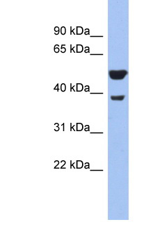 WNT3A Antibody - WNT3A antibody Western blot of Mouse Pancreas lysate. Antibody concentration 1 ug/ml. This image was taken for the unconjugated form of this product. Other forms have not been tested.