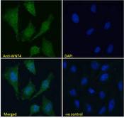 WNT4 Antibody - WNT4 antibody immunofluorescence analysis of paraformaldehyde fixed HeLa cells, permeabilized with 0.15% Triton. Primary incubation 1hr (10ug/ml) followed by Alexa Fluor 488 secondary antibody (4ug/ml), showing vesicle staining. The nuclear stain is DAPI (blue). Negative control: Unimmunized goat IgG (10ug/ml) followed by Alexa Fluor 488 secondary antibody (2ug/ml).