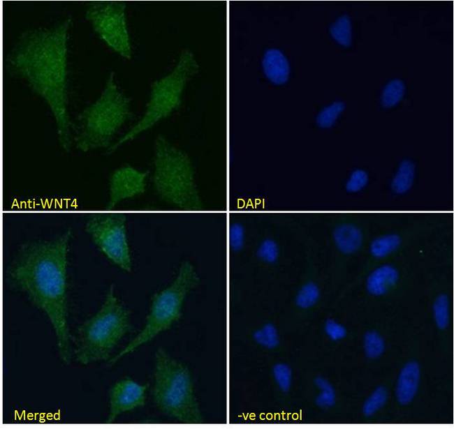 WNT4 Antibody - WNT4 antibody immunofluorescence analysis of paraformaldehyde fixed HeLa cells, permeabilized with 0.15% Triton. Primary incubation 1hr (10ug/ml) followed by Alexa Fluor 488 secondary antibody (4ug/ml), showing vesicle staining. The nuclear stain is DAPI (blue). Negative control: Unimmunized goat IgG (10ug/ml) followed by Alexa Fluor 488 secondary antibody (2ug/ml).