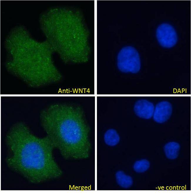 WNT4 Antibody - WNT4 antibody immunofluorescence analysis of paraformaldehyde fixed MCF7 cells, permeabilized with 0.15% Triton. Primary incubation 1hr (10ug/ml) followed by Alexa Fluor 488 secondary antibody (4ug/ml), showing vesicle staining. The nuclear stain is DAPI (blue). Negative control: Unimmunized goat IgG (10ug/ml) followed by Alexa Fluor 488 secondary antibody (2ug/ml).